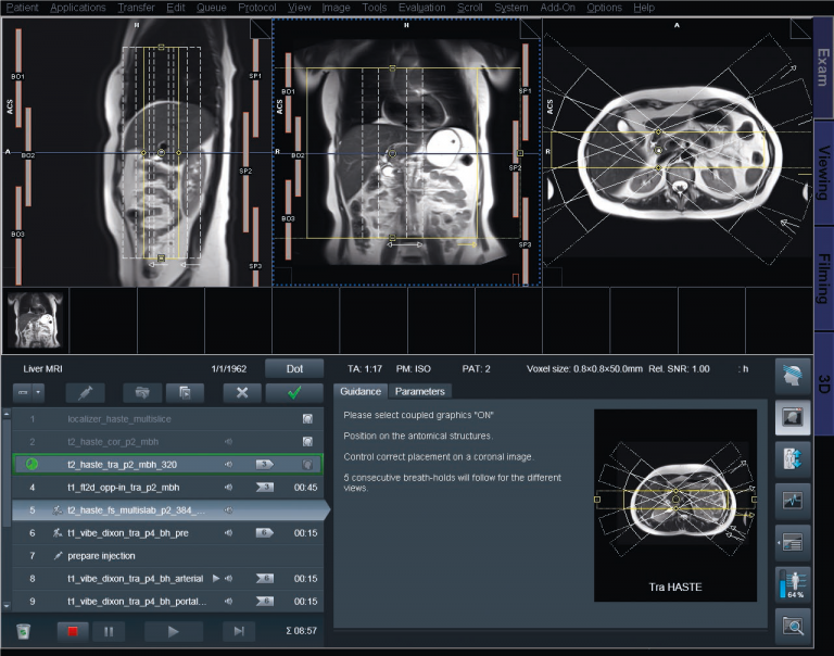 Primovist/ Eovist in Liver MRI FARSI